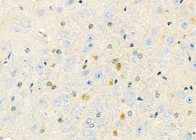 PJA Antibody in Immunohistochemistry (Paraffin) (IHC (P))