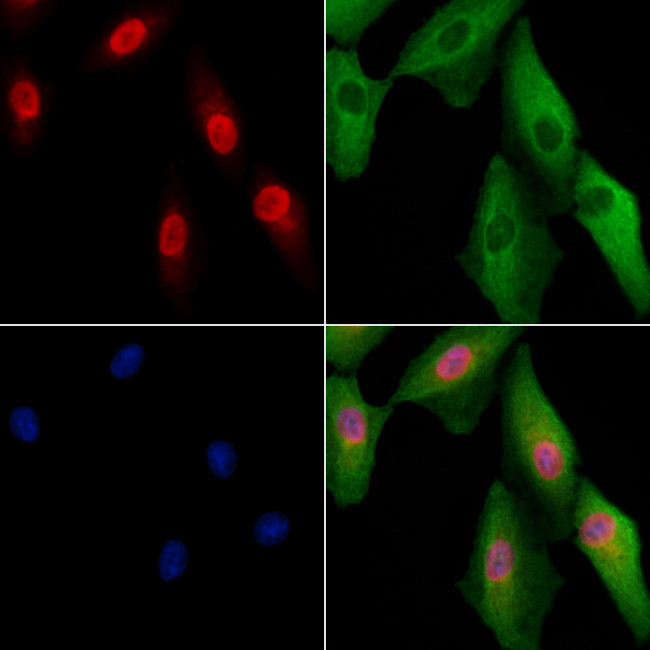 NEIL2 Antibody in Immunocytochemistry (ICC/IF)