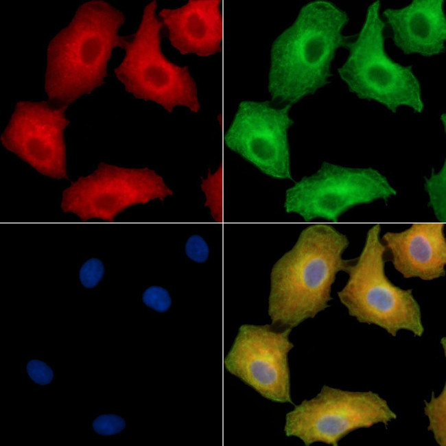 EDEM2 Antibody in Immunocytochemistry (ICC/IF)