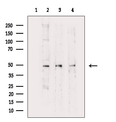 eIF5 Antibody in Western Blot (WB)