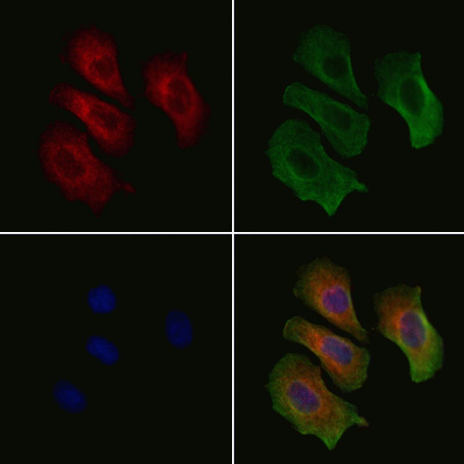 ETAA1 Antibody in Immunocytochemistry (ICC/IF)
