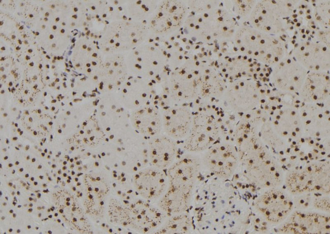 FANCM Antibody in Immunohistochemistry (Paraffin) (IHC (P))