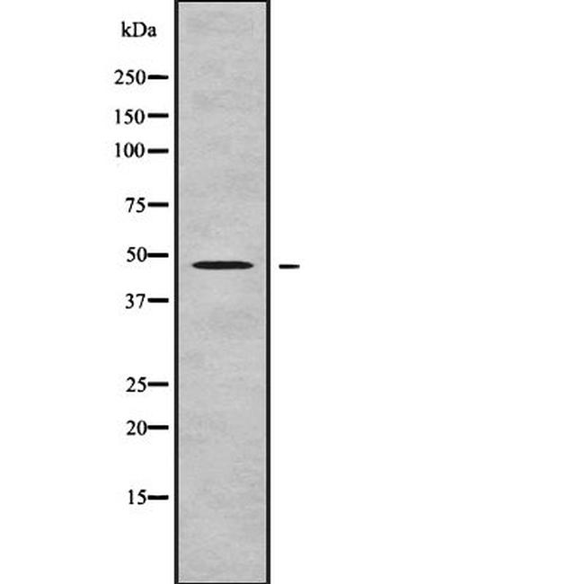 FOXD4L5 Antibody in Western Blot (WB)
