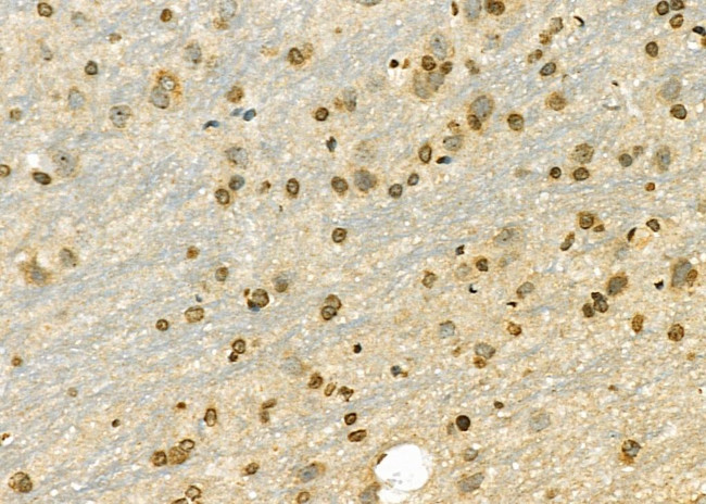 GPATCH8 Antibody in Immunohistochemistry (Paraffin) (IHC (P))
