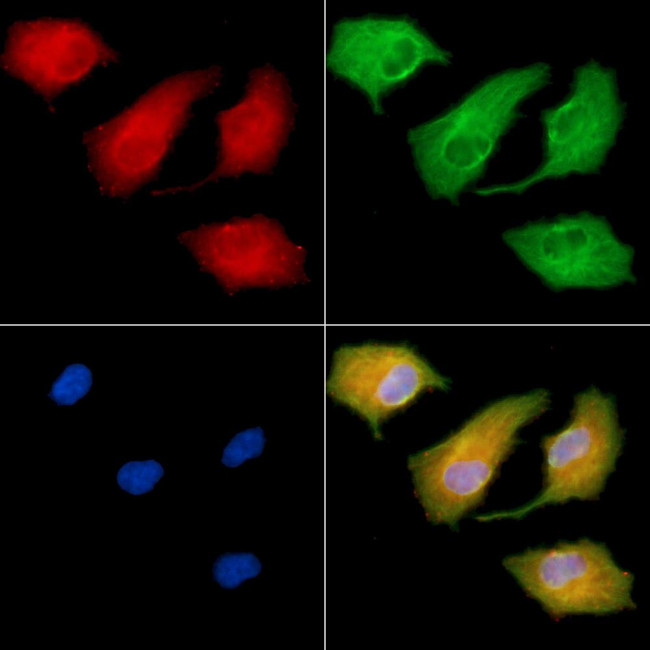 Connexin 31.1 Antibody in Immunocytochemistry (ICC/IF)