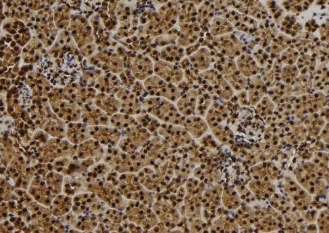 QSER1 Antibody in Immunohistochemistry (Paraffin) (IHC (P))