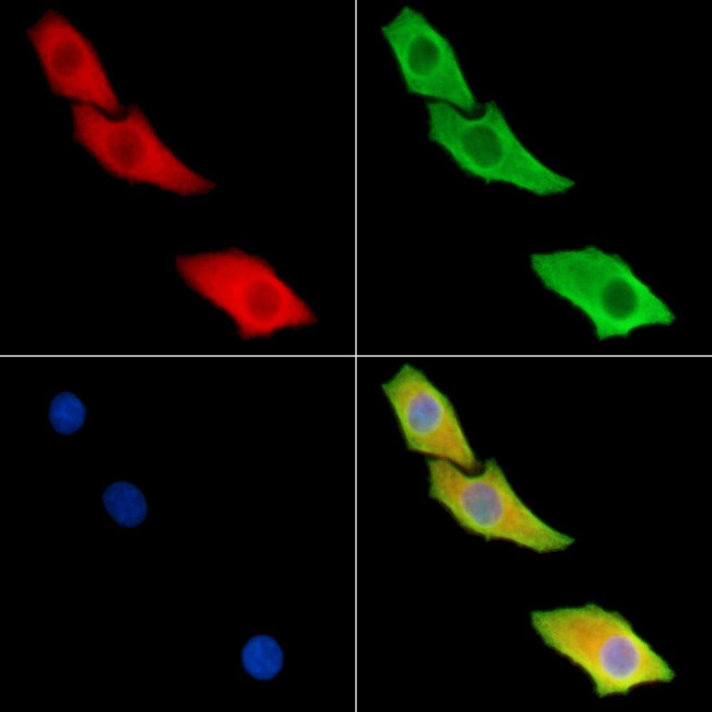 REM2 Antibody in Immunocytochemistry (ICC/IF)