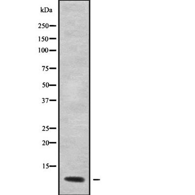 Gng12 Antibody in Western Blot (WB)