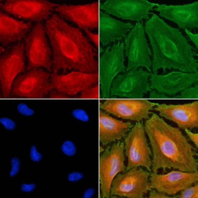 HLA-DMA Antibody in Immunocytochemistry (ICC/IF)