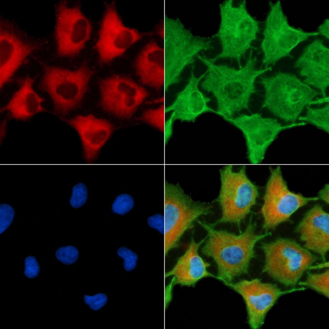HLA-DQB2 Antibody in Immunocytochemistry (ICC/IF)