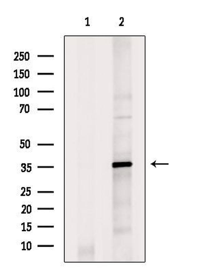 HOXC12 Antibody in Western Blot (WB)