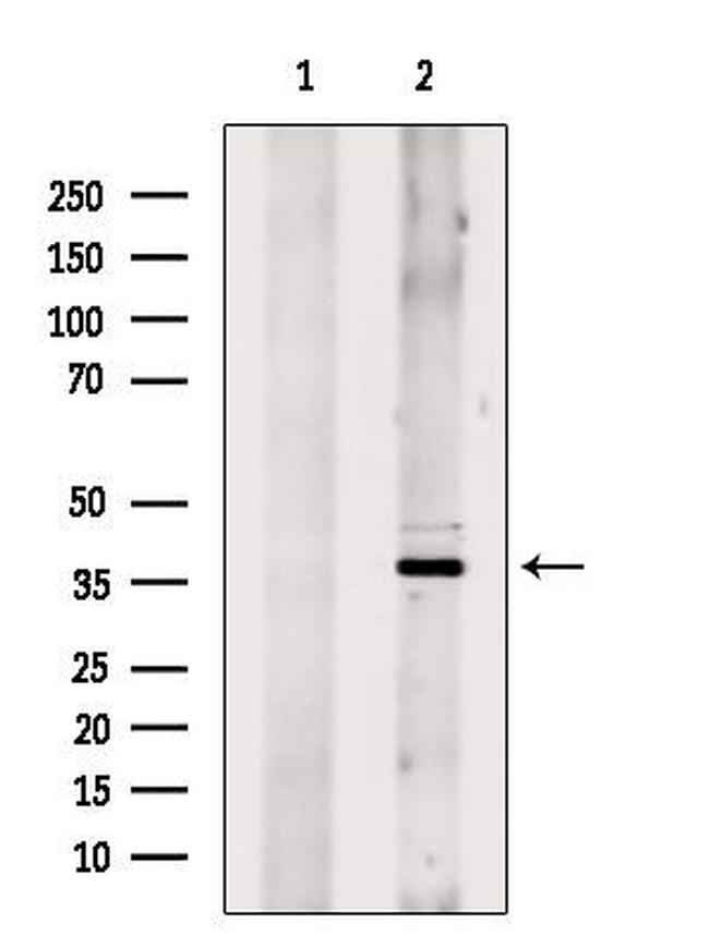 HOXD9 Antibody in Western Blot (WB)