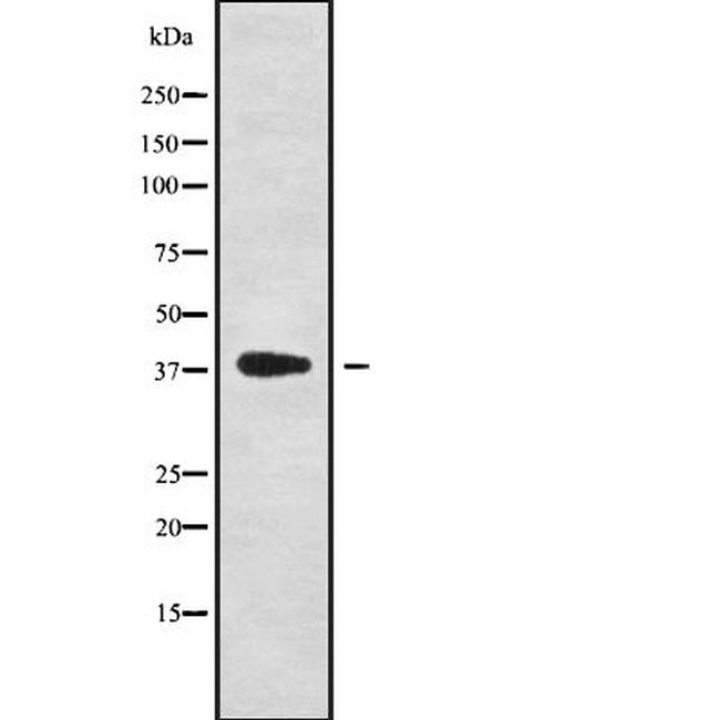 Nkx6.1 Antibody in Western Blot (WB)