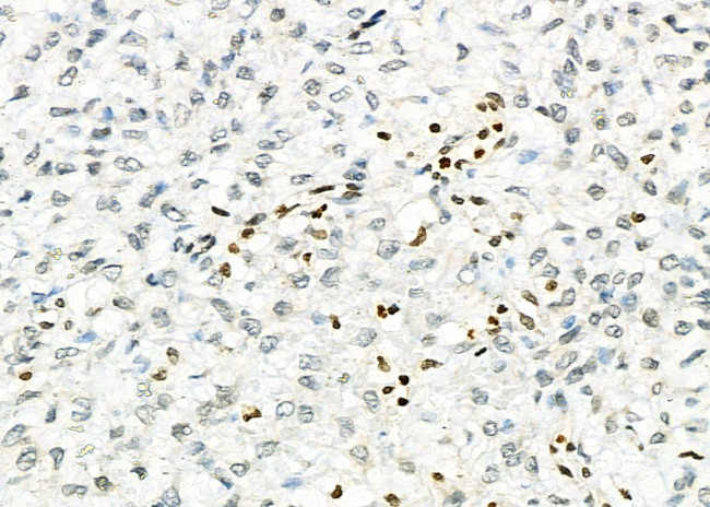 NKX6-2 Antibody in Immunohistochemistry (Paraffin) (IHC (P))
