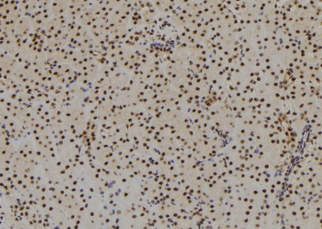 SIX3 Antibody in Immunohistochemistry (Paraffin) (IHC (P))