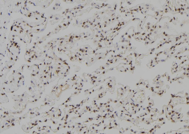 TGIF2LX Antibody in Immunohistochemistry (Paraffin) (IHC (P))