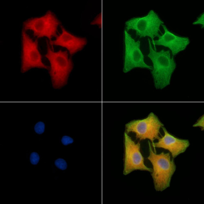 CD179a Antibody in Immunocytochemistry (ICC/IF)