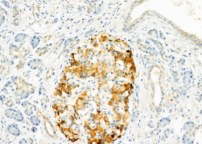 USP54 Antibody in Immunohistochemistry (Paraffin) (IHC (P))
