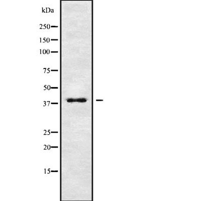KIR2DL2 Antibody in Western Blot (WB)