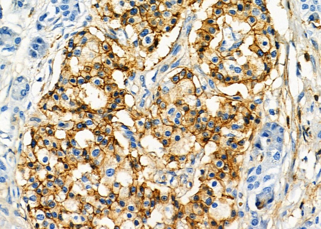 KIR2DL5A Antibody in Immunohistochemistry (Paraffin) (IHC (P))