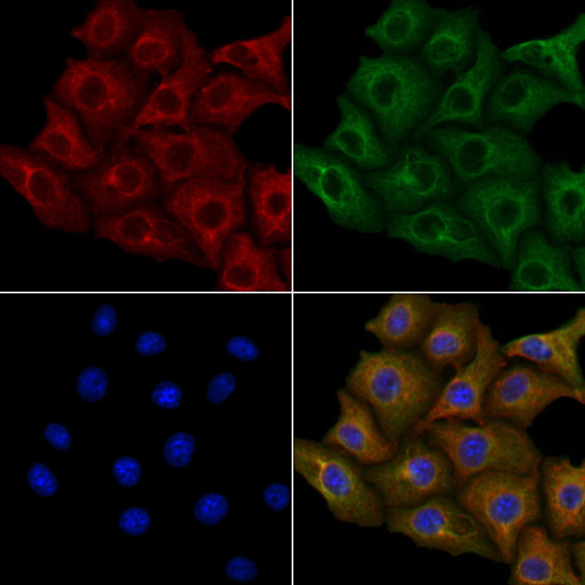 KIR2DS5 Antibody in Immunocytochemistry (ICC/IF)