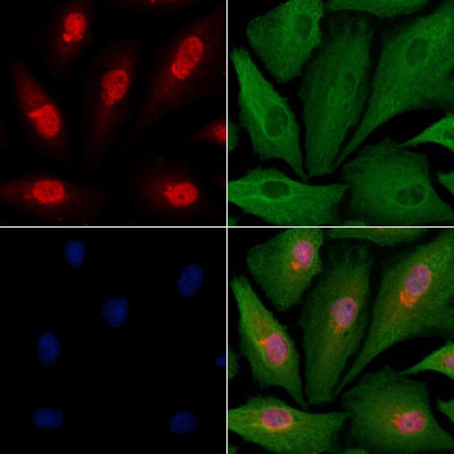 MED11 Antibody in Immunocytochemistry (ICC/IF)