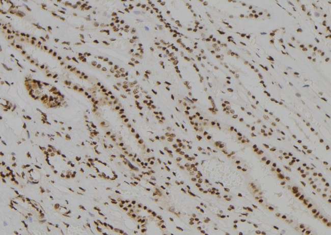 MED22 Antibody in Immunohistochemistry (Paraffin) (IHC (P))