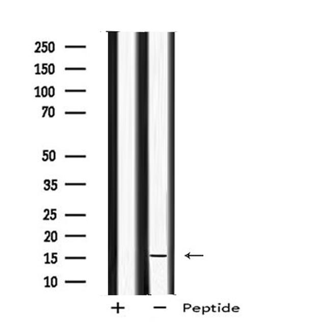 MED9 Antibody in Western Blot (WB)