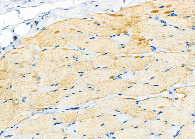 MRPL23 Antibody in Immunohistochemistry (Paraffin) (IHC (P))