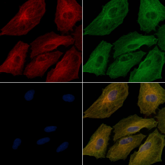 MUC6 Antibody in Immunocytochemistry (ICC/IF)