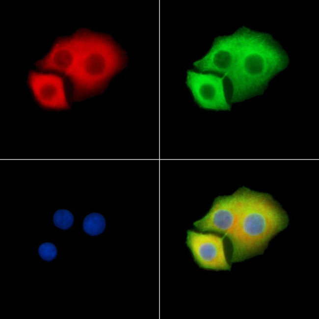 MYO3B Antibody in Immunocytochemistry (ICC/IF)