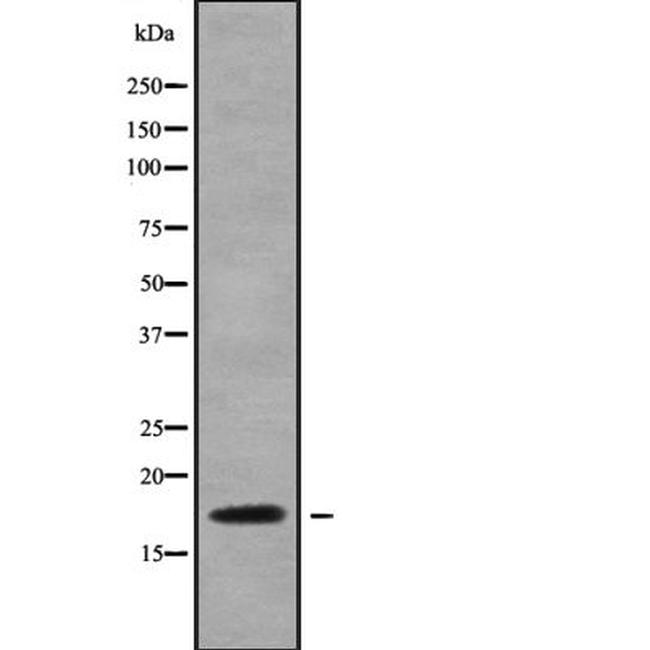 NDUFA6 Antibody in Western Blot (WB)