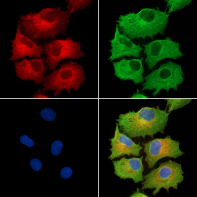 NDUFB5 Antibody in Immunocytochemistry (ICC/IF)
