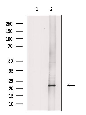 NDUFB8 Antibody in Western Blot (WB)