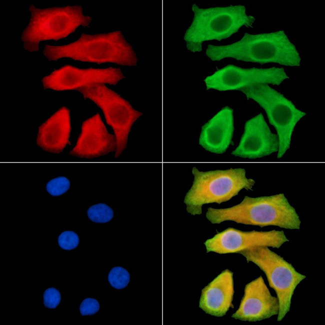 ND2 Antibody in Immunocytochemistry (ICC/IF)