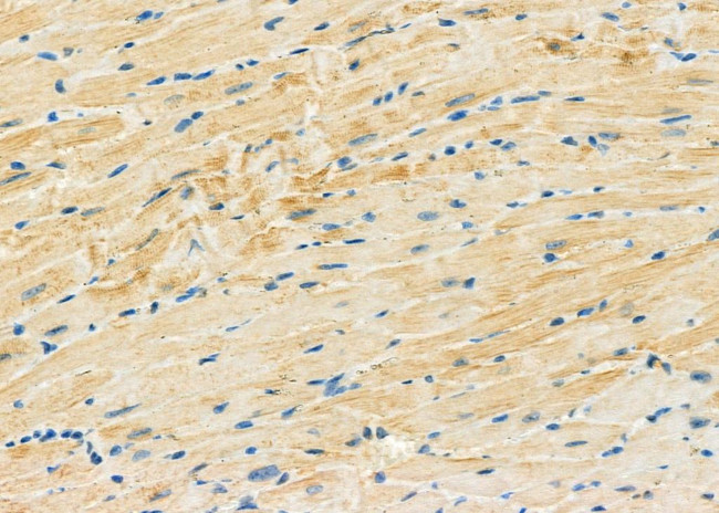 MT-ND4L Antibody in Immunohistochemistry (Paraffin) (IHC (P))