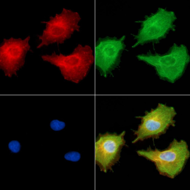MT-ND6 Antibody in Immunocytochemistry (ICC/IF)