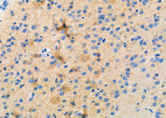 NCALD Antibody in Immunohistochemistry (Paraffin) (IHC (P))