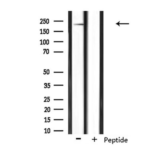 NAV1 Antibody in Western Blot (WB)