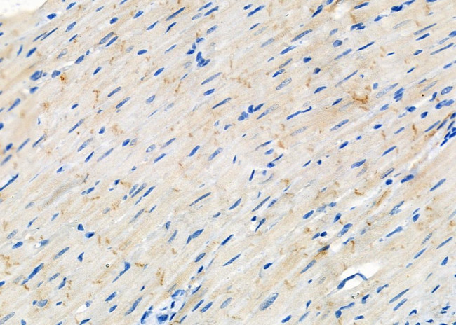 CHRNB3 Antibody in Immunohistochemistry (Paraffin) (IHC (P))