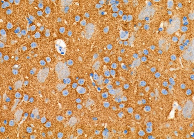 GPM6B Antibody in Immunohistochemistry (Paraffin) (IHC (P))
