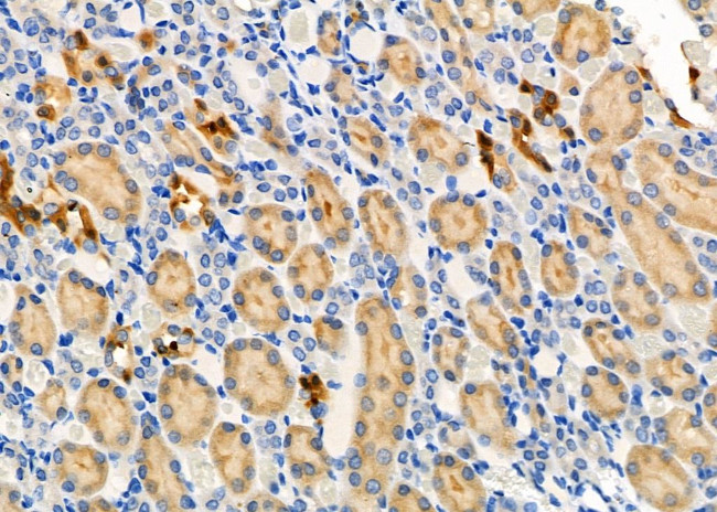 NTS Antibody in Immunohistochemistry (Paraffin) (IHC (P))