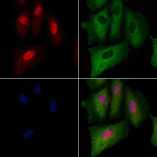 NUP88 Antibody in Immunocytochemistry (ICC/IF)