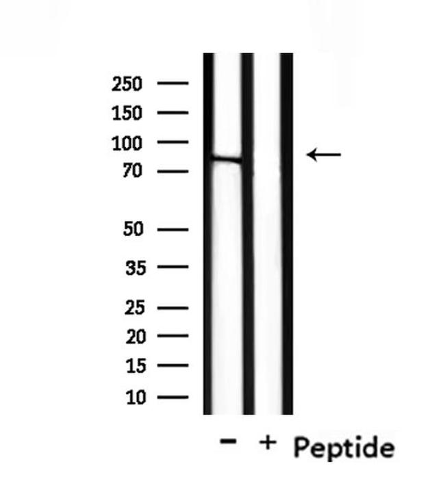 NOL11 Antibody in Western Blot (WB)