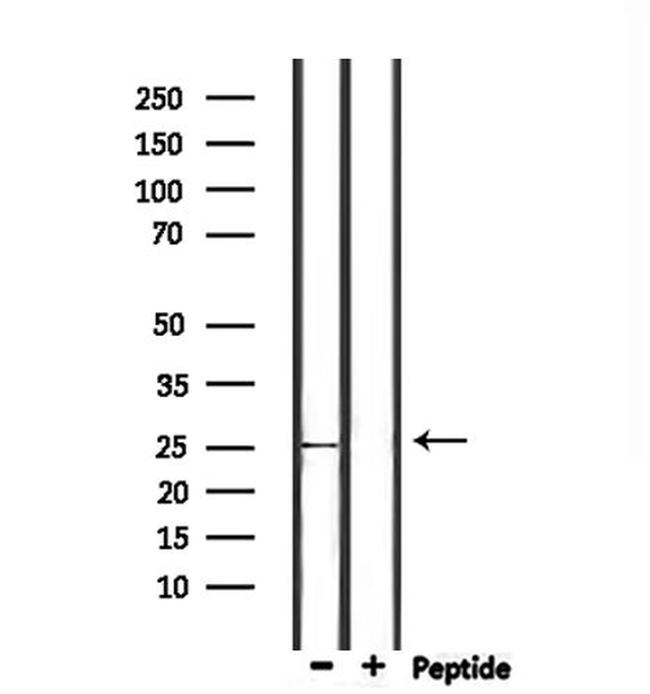 Nop25 Antibody in Western Blot (WB)