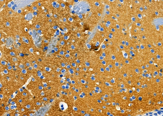OR6N1 Antibody in Immunohistochemistry (Paraffin) (IHC (P))