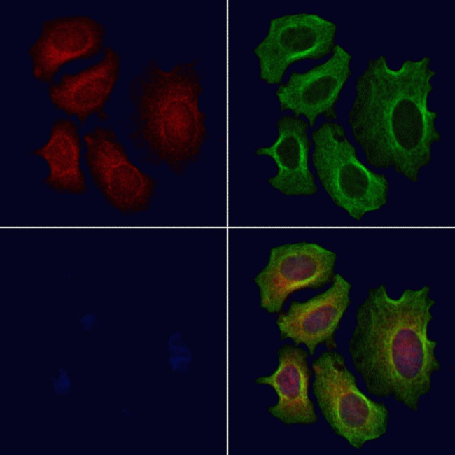 CROT Antibody in Immunocytochemistry (ICC/IF)
