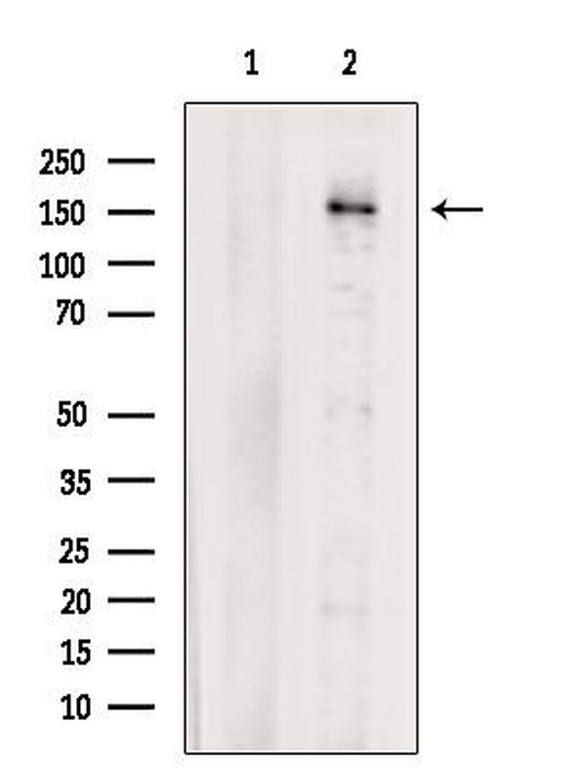 PREX1 Antibody in Western Blot (WB)
