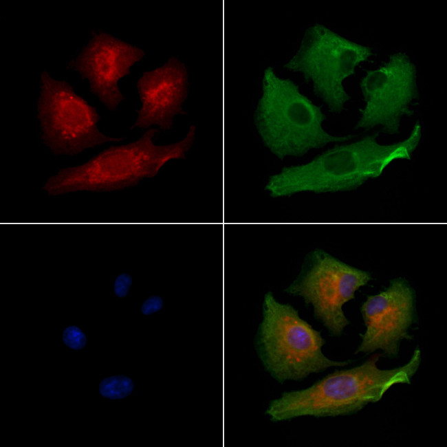 PIGP Antibody in Immunocytochemistry (ICC/IF)