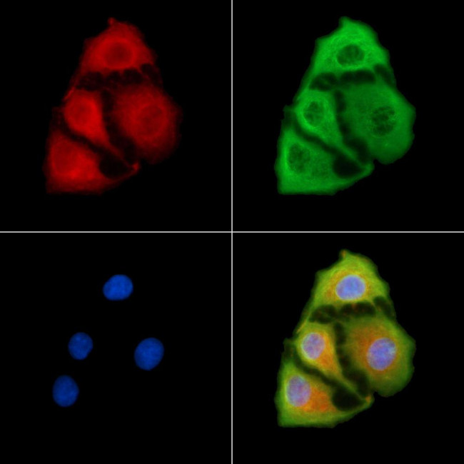 ATP2B1/2/3 Antibody in Immunocytochemistry (ICC/IF)